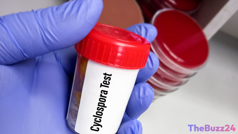 Record Cyclospora Outbreak Grips Michigan, Spreads to Ohio