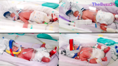 Medical Miracle: Rare Identical Quadruplets Born in Australia