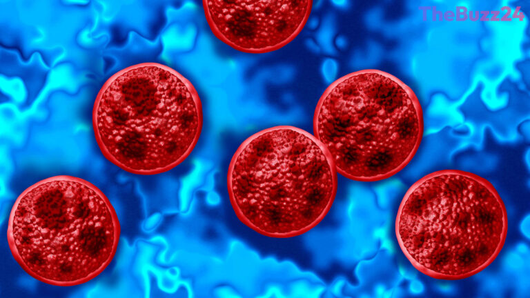 Michigan Reports First Fatalities in Severe National Cyclospora Outbreak