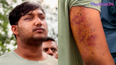 Forensic Experts Confirm Use of Pellet Guns Against Protesters in Delhi