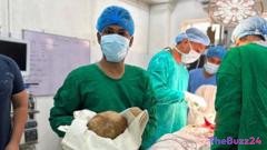 Medical Marvel: Sri Lankan Surgeons Extract World’s Heaviest Bladder Stone