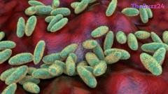 Understanding Pneumonic Plague: Risks, Transmission, and Medical Reality