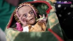 Yemen’s Deepening Humanitarian Crisis: Newborn Twins’ Struggle Highlights Nation’s Dire Plight