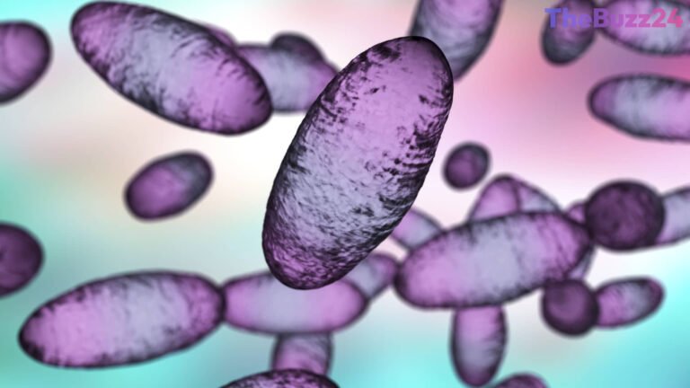 Suspected Plague Fatality at Russian Institute Prompts Extensive Health Monitoring
