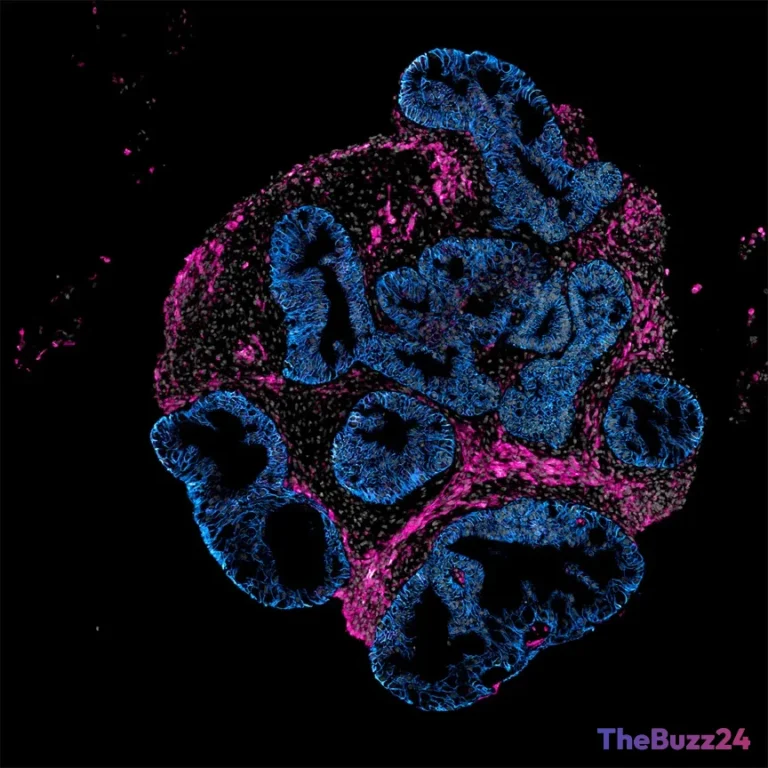 Miniature Human Intestines Grown in Lab Offer New Hope for Drug Testing