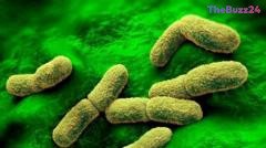 Siberian Lab Death Prompts Global Scrutiny Over Plague Containment